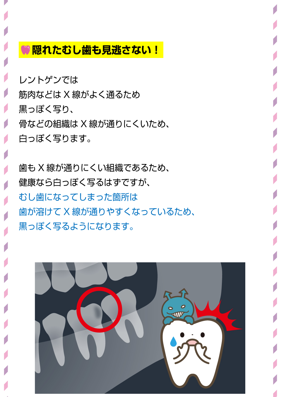 こんなことまで全部見える！レントゲンでわかること2