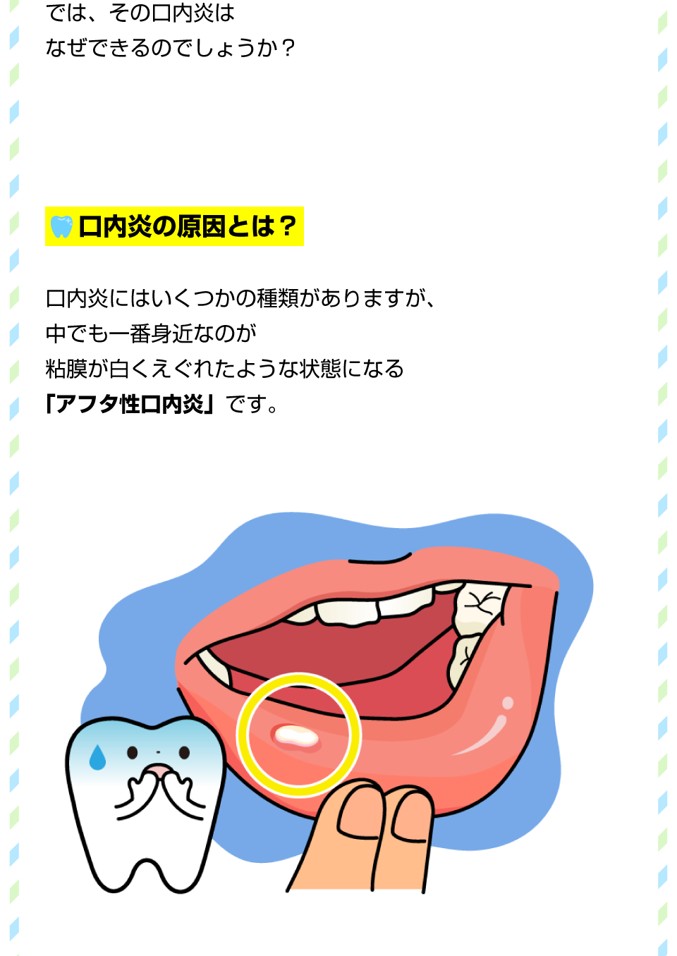 イタイ！口内炎ができたらどうすれば？2