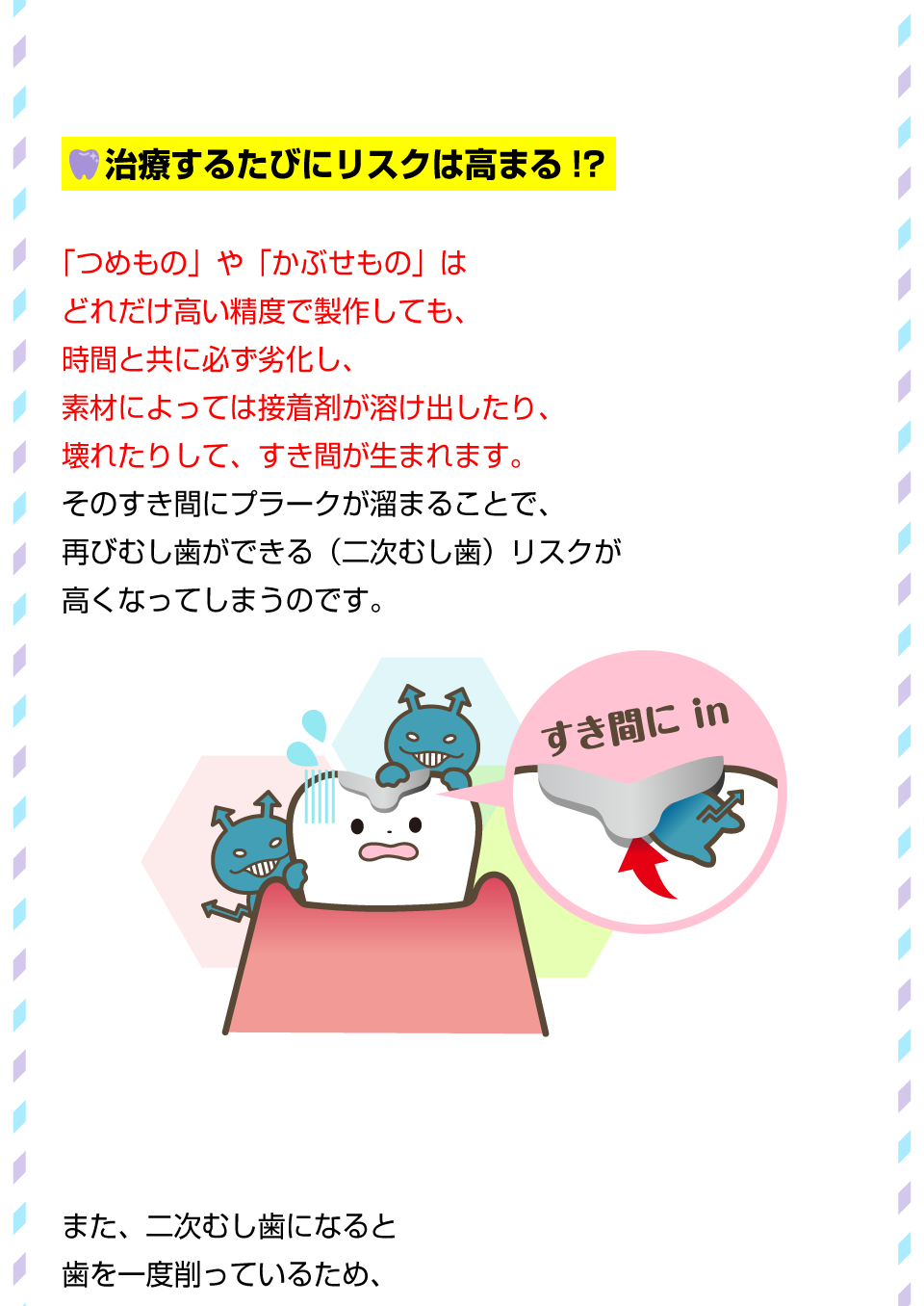 むし歯の再発にご用心！2